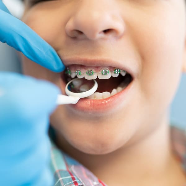 Orthodontics treatable conditions, Ottawa Dentist