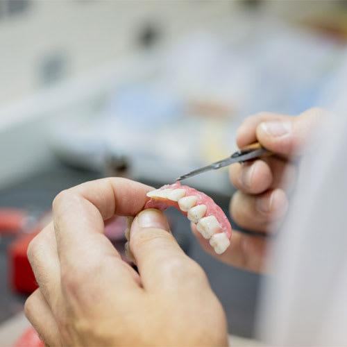 What are Dentures? | Manor Park Dental, Ottawa